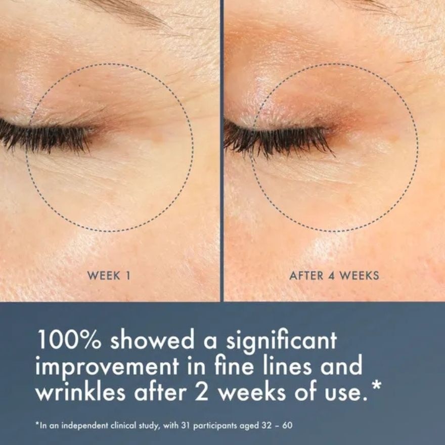SUMMER FRIDAYS JET LAG OVERNIGHT EYE SERUM 15ML image